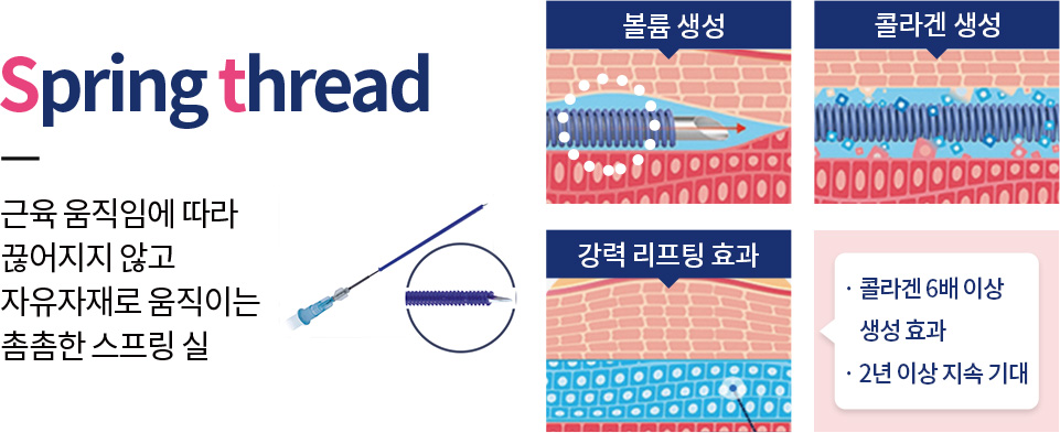 근육 움직임에 따라 끊어지지 않고 자유자재로 움직이는 촘촘한 스프링 실 영등포피부과-영등포역피부과 순간의 선택, 빛나는 외모 영등포피부과 미앤미